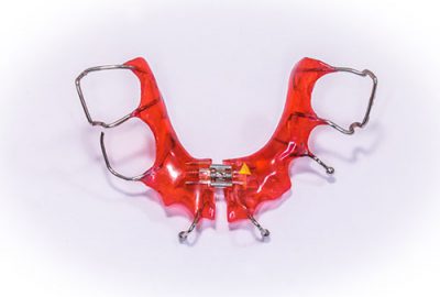 Palate Expander