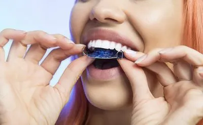 teen putting retainer in her mouth