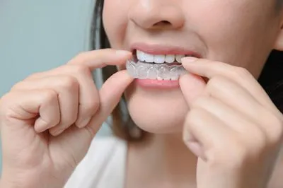 invisalign unit
